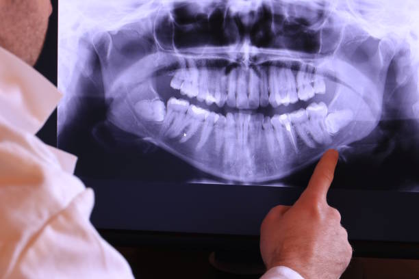 Best Urgent Tooth Repair  in Holley, NY