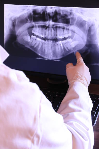 Best Tooth Infection Emergency Dentist  in Holley, NY