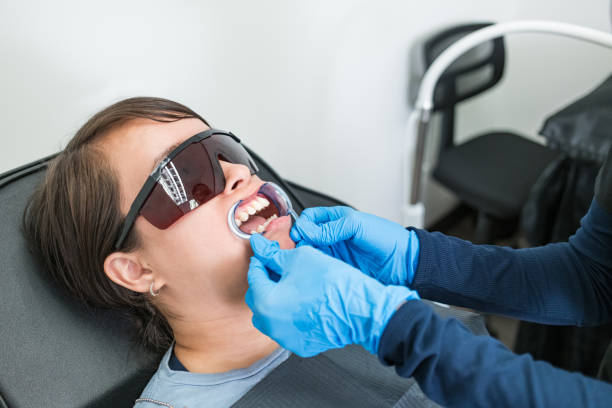 Best Teeth Whitening  in Holley, NY
